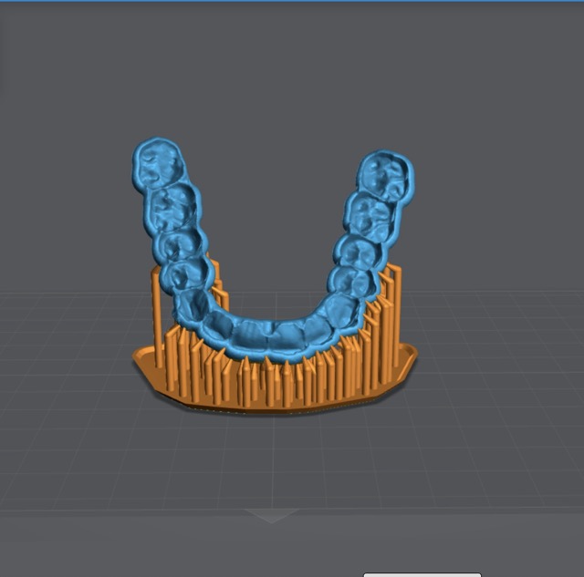 Surgical guide with well-placed supports